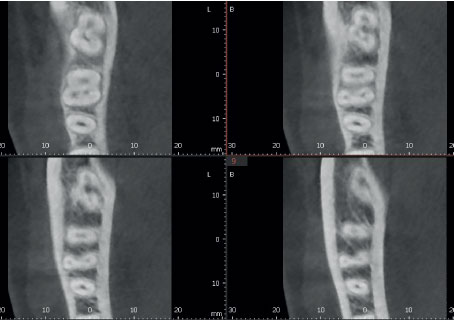 Обычный режим