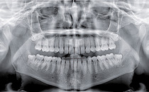 Пародонтальные процедуры Ortho PAN