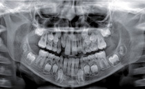 Пародонтальные процедуры Ortho PAN