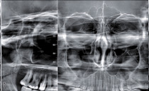 Пародонтальные процедуры Ortho PAN