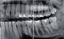 Пародонтальные процедуры Ortho PAN