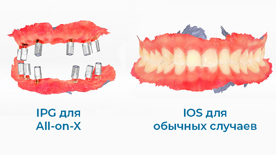 Aoralscan Elite Wireless