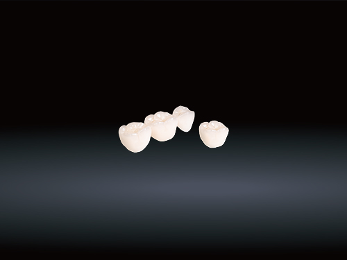 Коронки и мосты