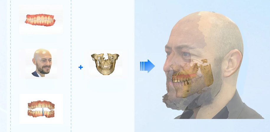 Цифровой 3D-аватар в стоматологии: что это такое и зачем он нужен клинике