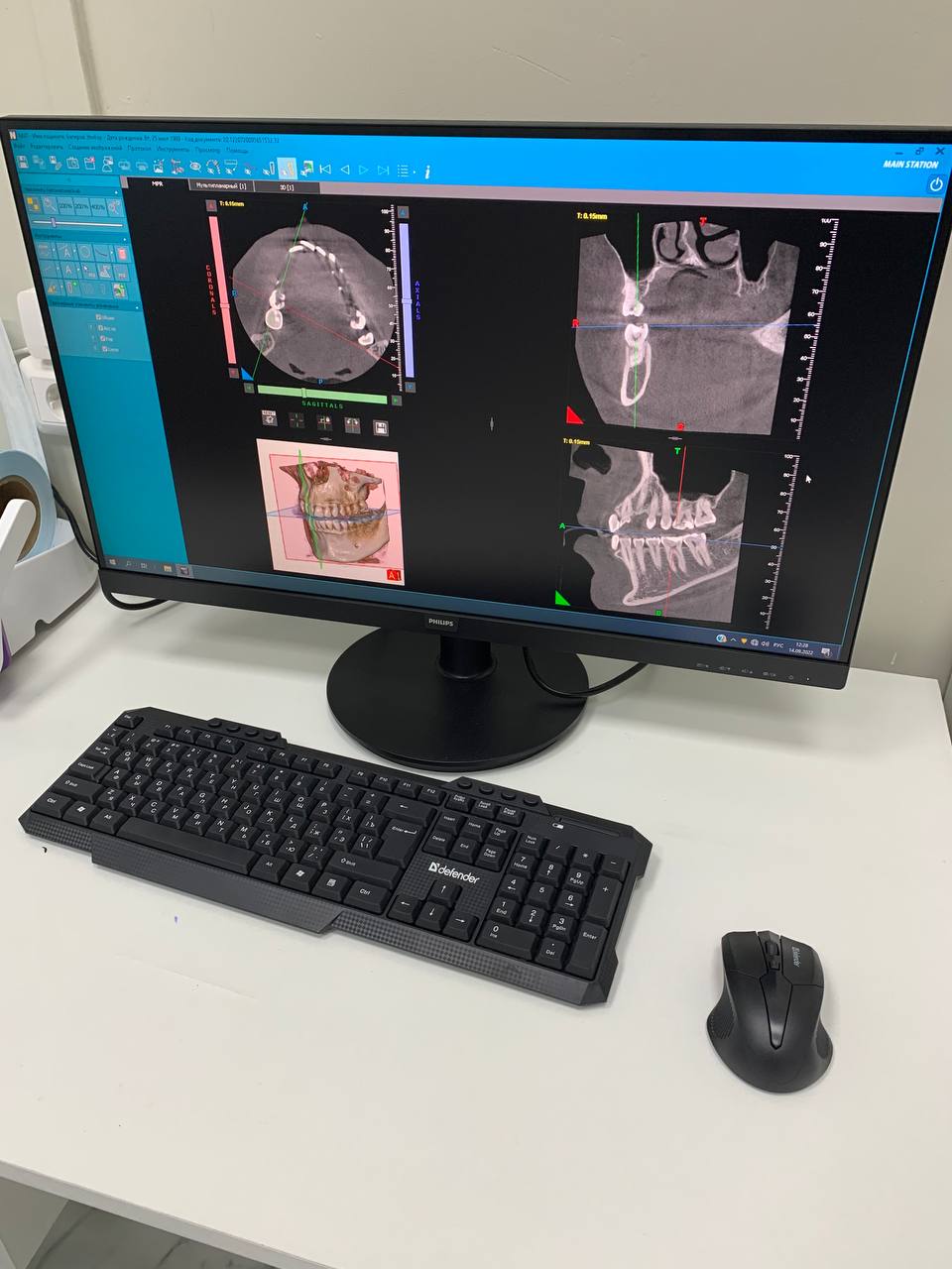 Запуск в работу компьютерного томографа NewTom 2D/3D GO 10x10 (Италия)