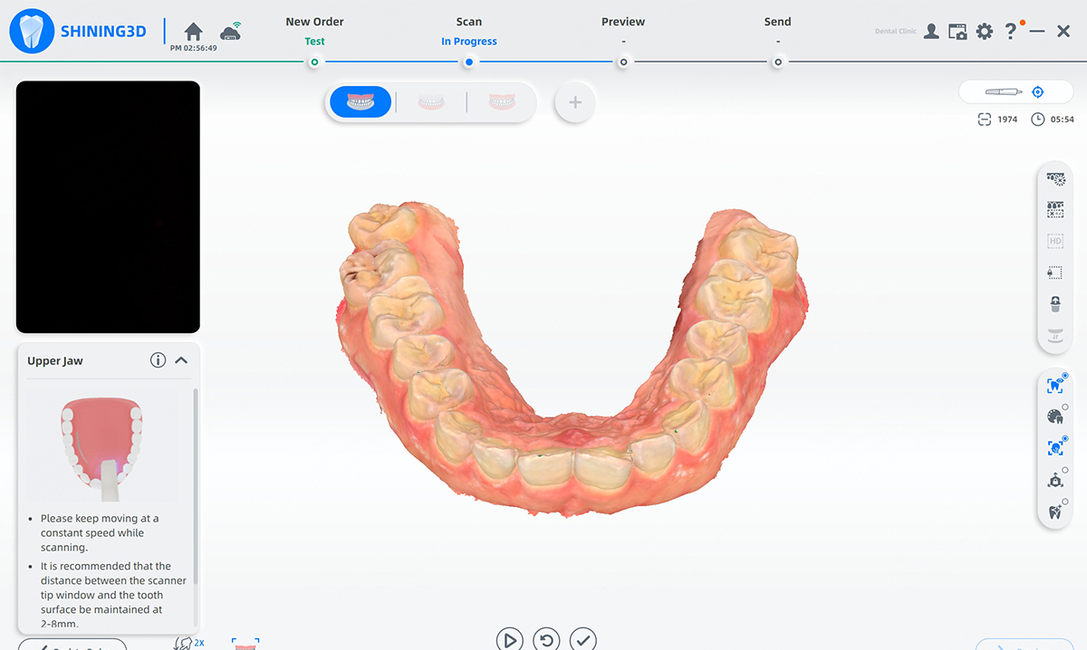 Aoralscan Lync