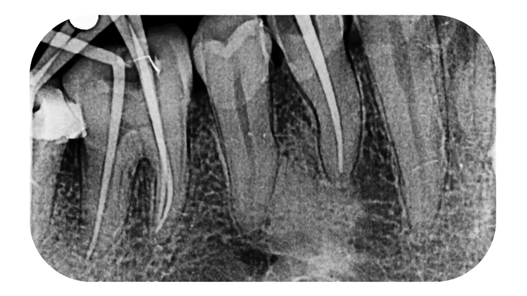 Высокое разрешение