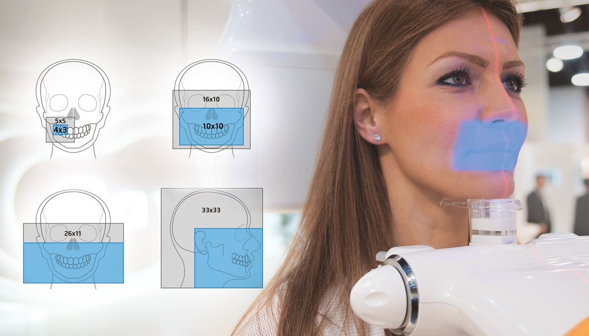 Свободный FOV