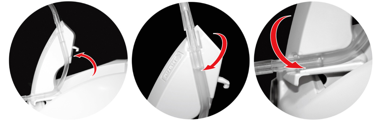 Простая замена ирригационной трубки