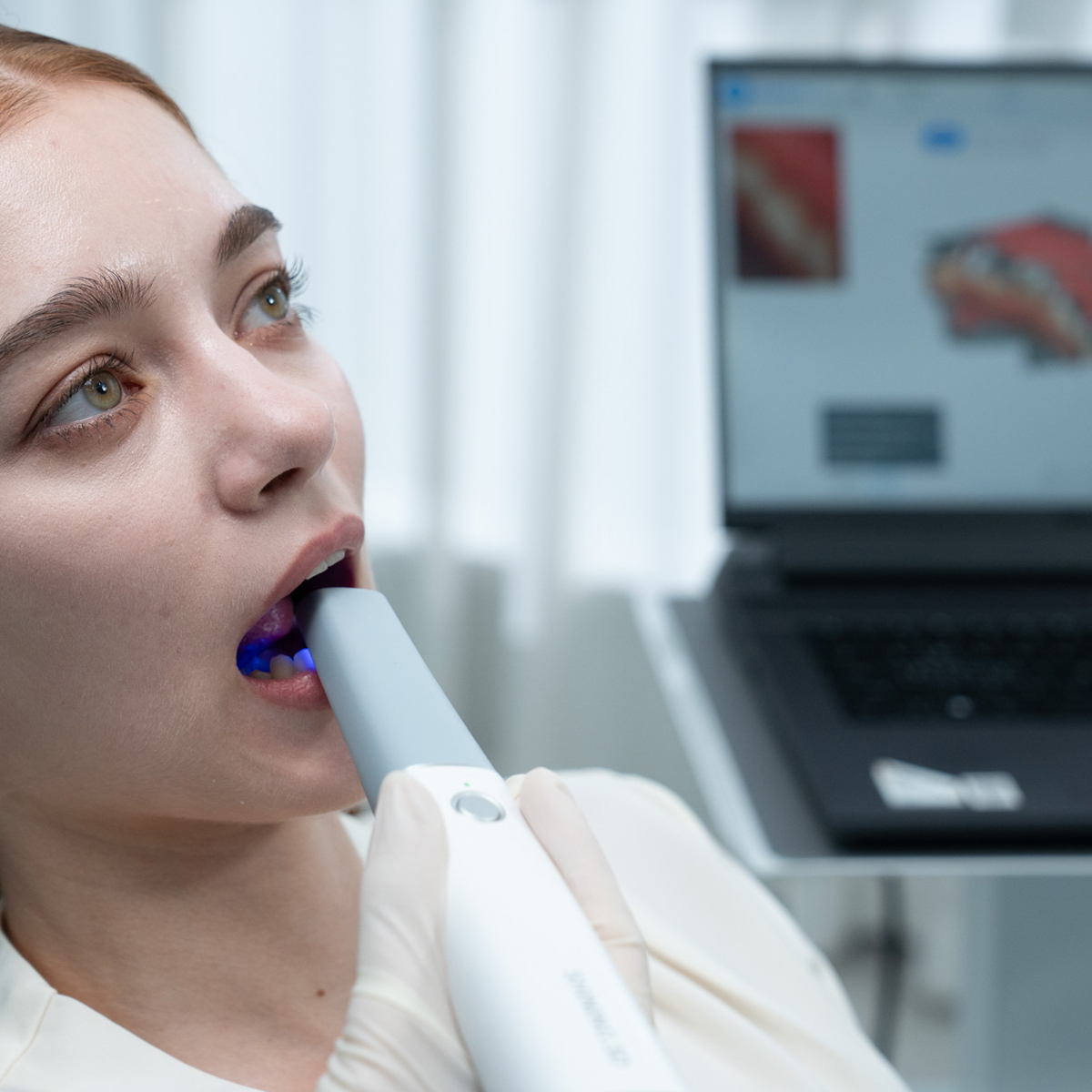 Интраоральный сканер Aoralscan Lync