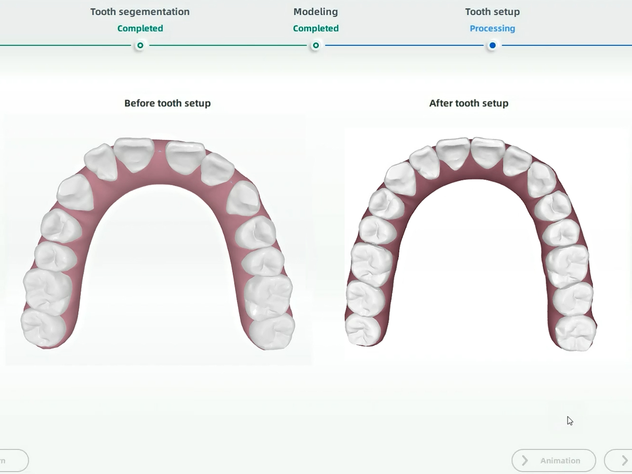 Планирование лечения