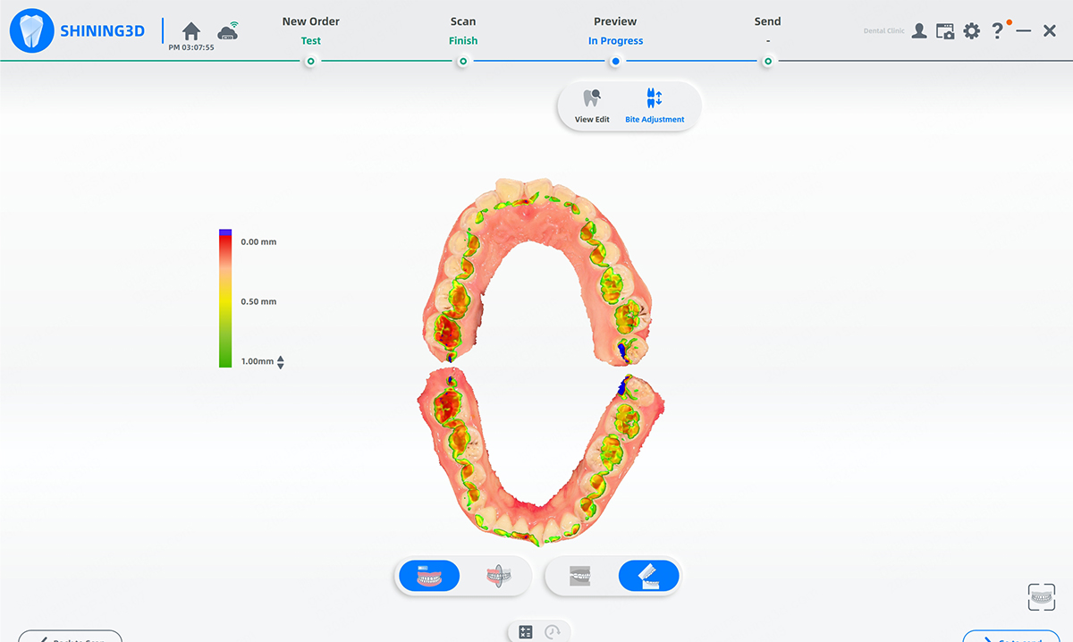 Aoralscan Lync