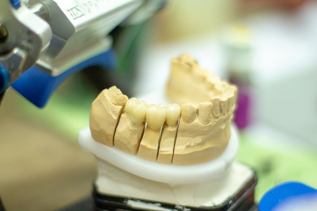 CAD CAM Зубные протезы