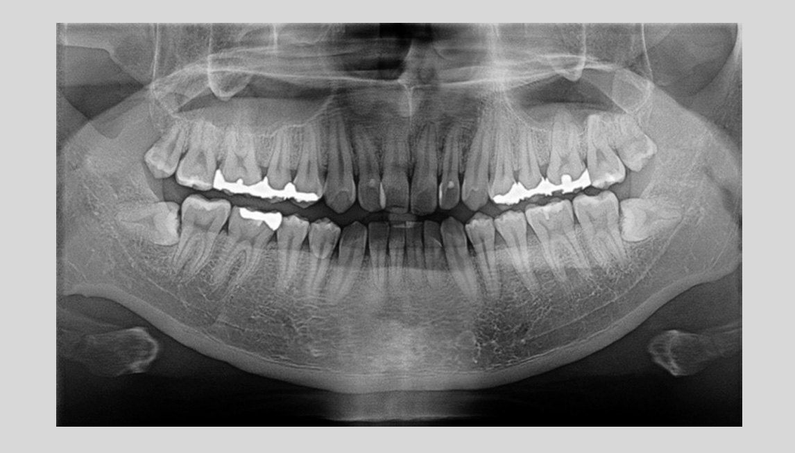 Ортогональный