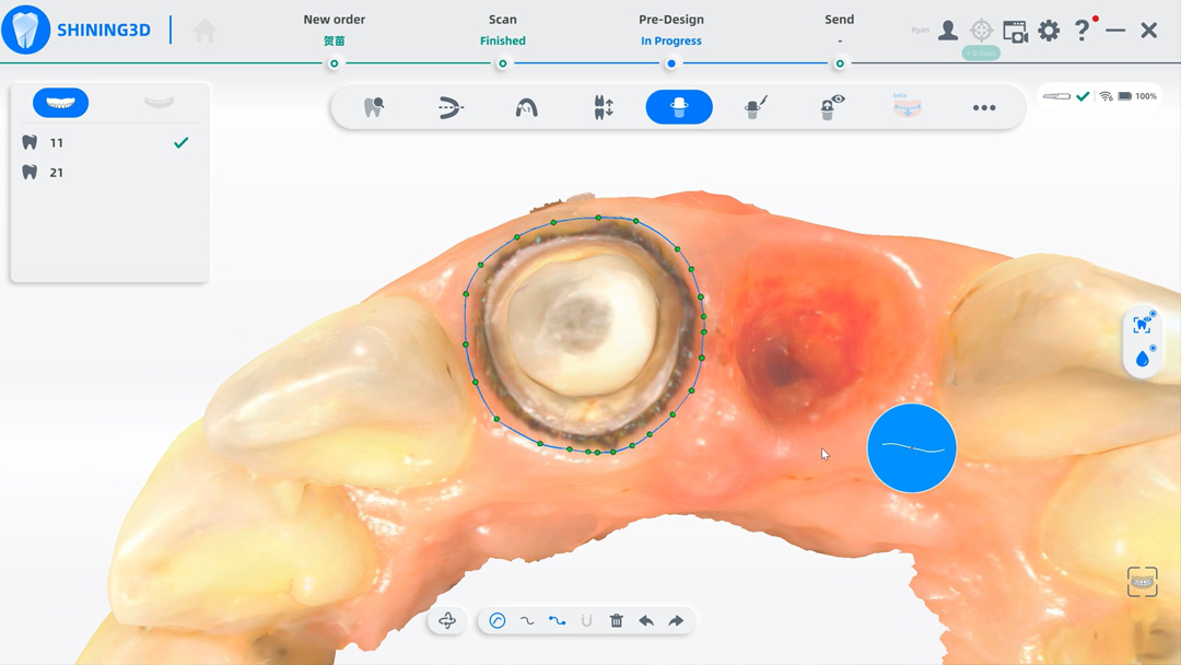 Распознавание маржинальной линии