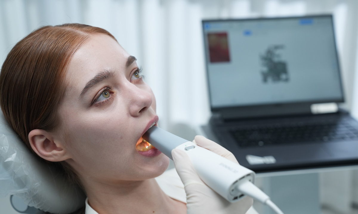 Aoralscan Lync