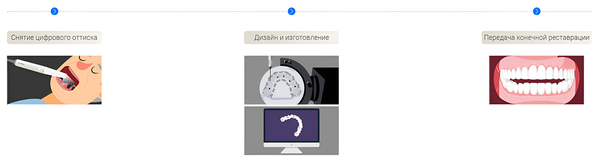 Рабочий процесс Aoralscan Elite