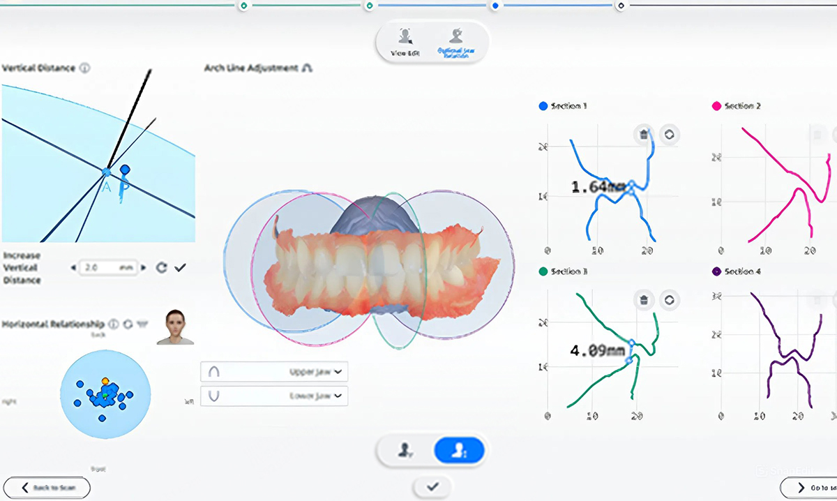 Анализ движений челюсти