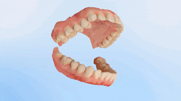 Визуализация прикуса