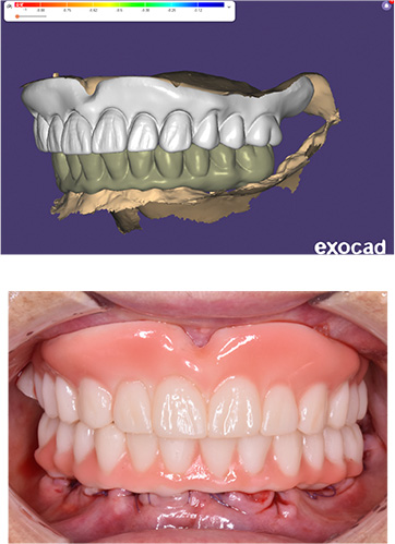 Через проектирование
