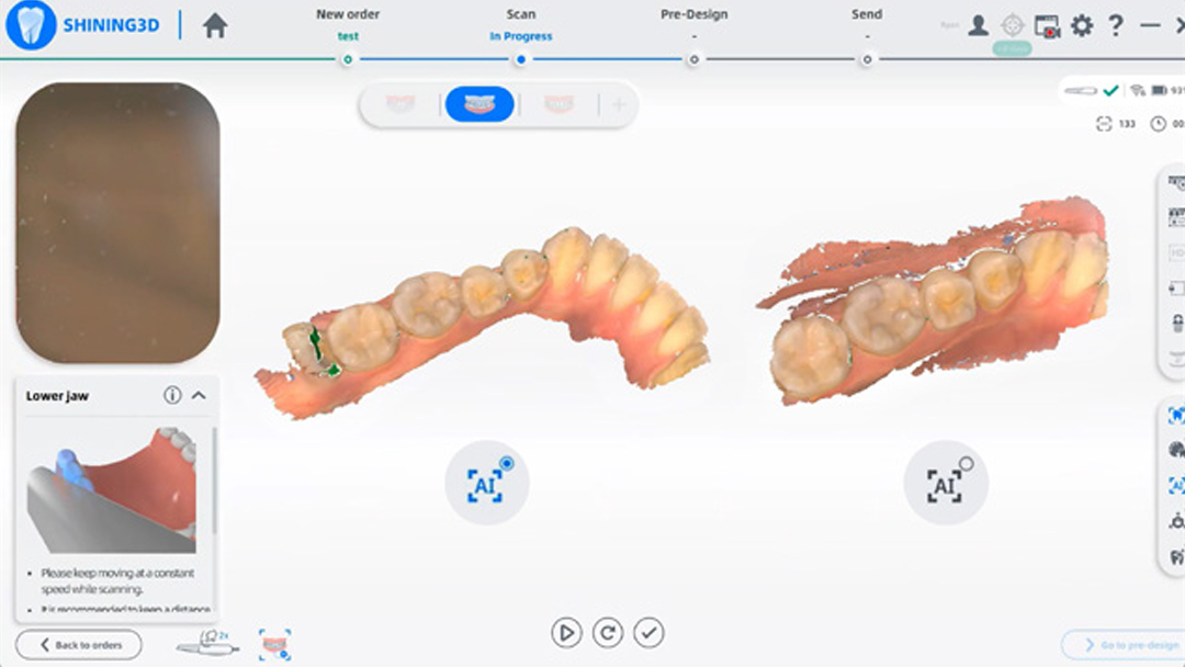 Интеллектуальное сканирование