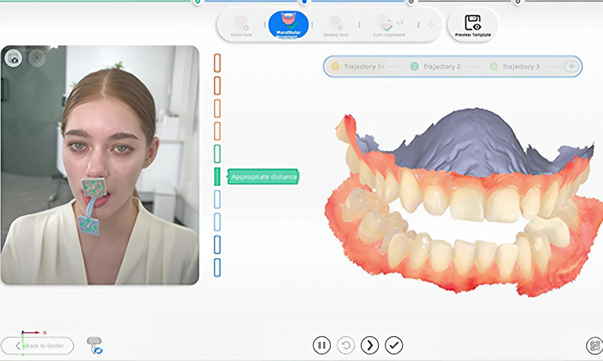 Отслеживание траектории движений челюсти