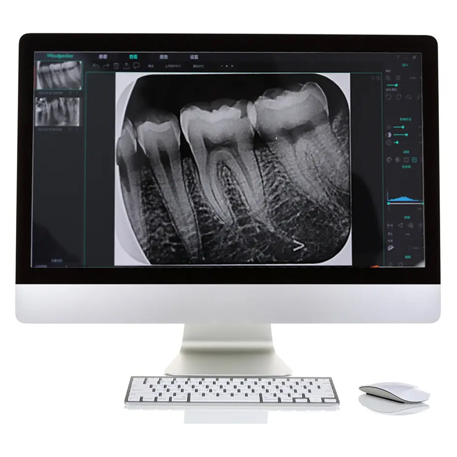 Детализированные стоматологические пленки