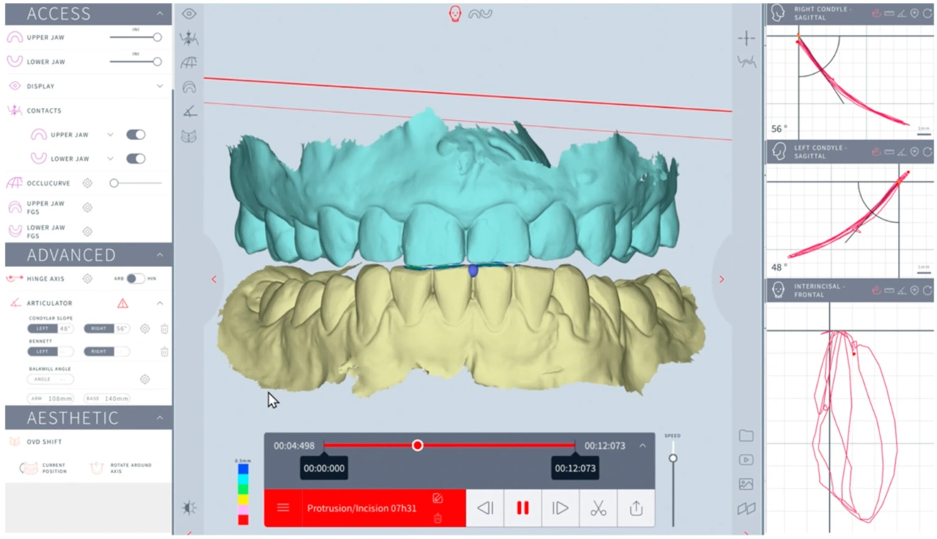 Передача данных в ПО и анализ