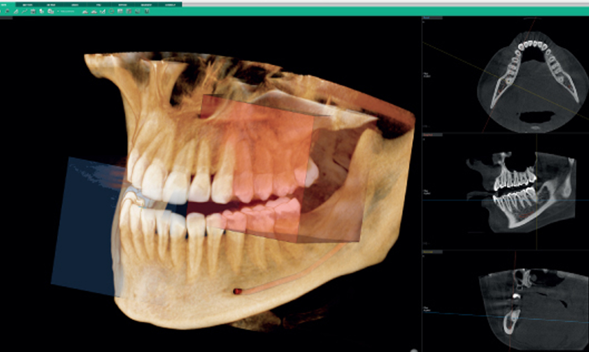 Цифровой аватар
