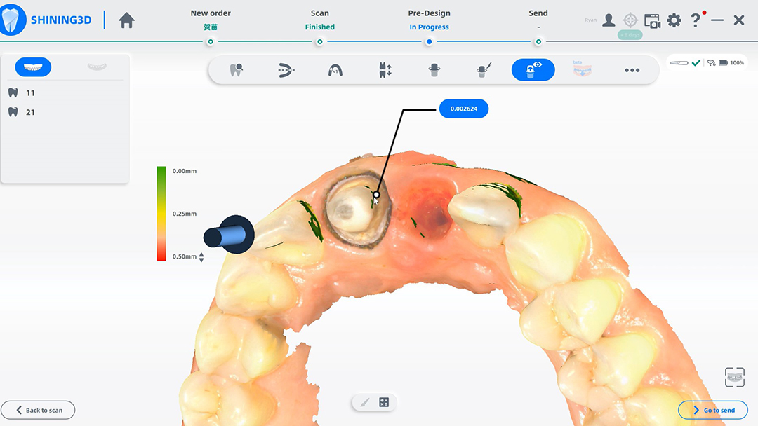 Анализ препарирования