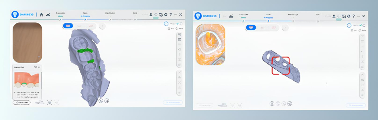 Сканирование оттисков Сканирование оттисков