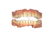 Траектория движения нижней челюсти