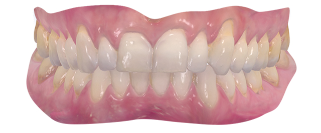 3d-skaner-3shape-trios-wireless-3 (1).jpg