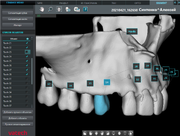 Функция виртуального удаления зубов