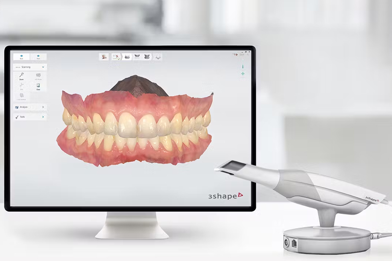 Интраоральное санирование