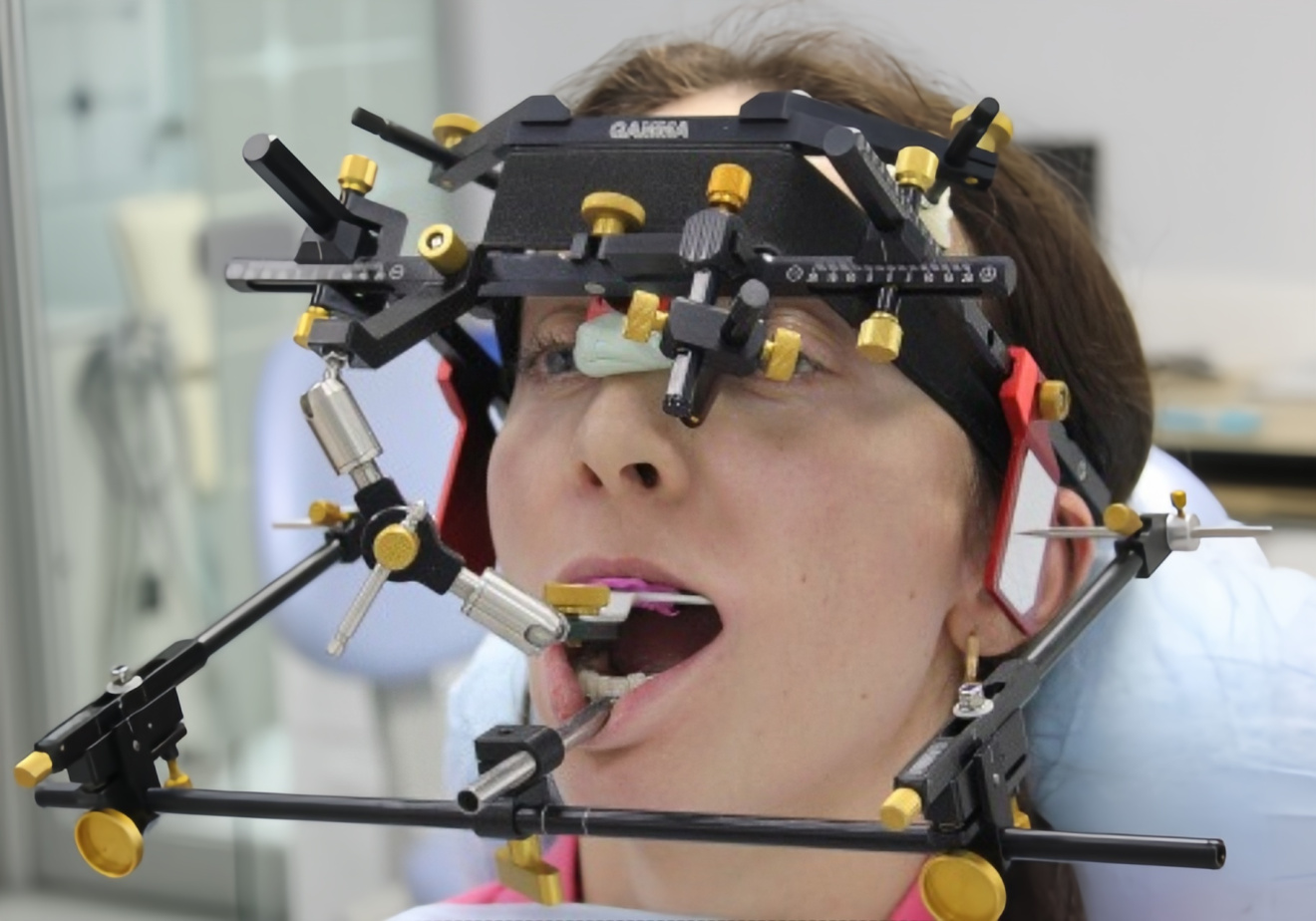 Показания к использованию CADIAX 4