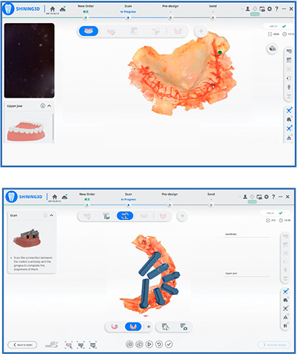 Стандартное послеоперационное