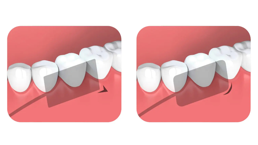 Области применения